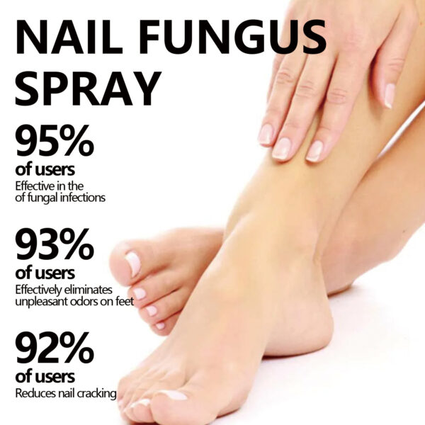 Deodorant Deodorant Deodorant Gray Nail Spray - Image 2